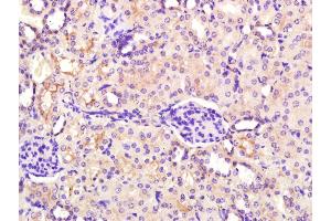 Immunohistochemistry (Paraffin-embedded Sections) (IHC (p)) image for anti-Mitochondrial E3 Ubiquitin Protein Ligase 1 (MUL1) (AA 45-95) antibody (ABIN1385942)