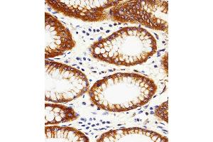 Immunohistochemical analysis of paraffin-embedded H. (Calpain 2 抗体  (AA 1-400))