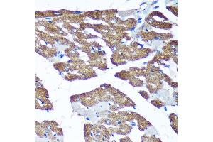Immunohistochemistry of paraffin-embedded Rat heart using TIMMDC1 Rabbit pAb (ABIN7270929) at dilution of 1:100 (40x lens). (TIMMDC1 抗体  (AA 206-285))