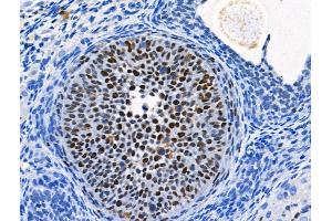 Phospho-MCM2 (Ser41) Antibody at 1/100 staining Rat ovarian tissue by IHC-P.