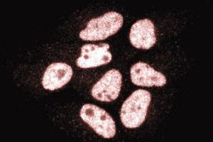 Immunofluorescence staining of HeLa cells (Human cervical epitheloid carcinoma, ATCC CCL-2. (CTBP1 抗体  (AA 345-441))