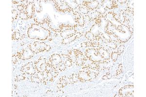 Immunohistochemistry (IHC) image for anti-ThPok (AA 250-300) antibody (ABIN7455169) (Recombinant ThPok (AA 250-300) 抗体)