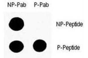 Dot Blot (DB) image for anti-Tumor Protein P53 (TP53) (pSer9) antibody (ABIN3029389)
