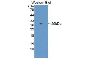 Detection of Recombinant WASP, Human using Polyclonal Antibody to Wiskott Aldrich Syndrome Protein (WASP) (WASP 抗体  (AA 39-251))