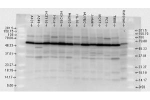 Hsp70, human cell lines, polyclonal (HSP70 抗体)