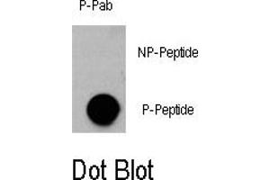 Image no. 1 for anti-V-Akt Murine Thymoma Viral Oncogene Homolog 3 (Protein Kinase B, Gamma) (AKT3) (pSer472) antibody (ABIN358400)