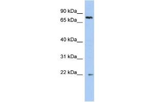 WB Suggested Anti-NHLRC2 Antibody Titration: 0. (NHLRC2 抗体  (N-Term))