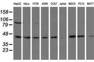 Western blot analysis of extracts (35 µg) from 9 different cell lines by using anti-ALDH1L1 monoclonal antibody. (ALDH1L1 抗体)