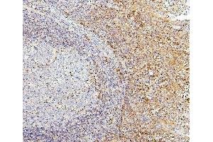 IHC analysis of PPCS using anti-PPCS antibody (ABIN7602752).