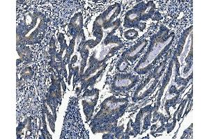 IHC analysis of Agrin/AGRN using anti-Agrin/AGRN antibody (ABIN7600387). (AGRN 抗体  (AA 1864-2068))