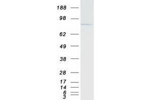 Validation with Western Blot