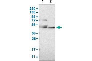Western Blot analysis with CYP26B1 polyclonal antibody . (CYP26B1 抗体  (AA 201-310))