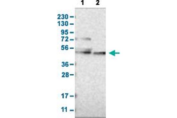 CYP26B1 抗体  (AA 201-310)