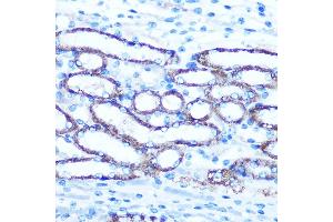 Immunohistochemistry of paraffin-embedded Mouse kidney using TBCCD1 Rabbit pAb (ABIN7270751) at dilution of 1:100 (40x lens). (TBCCD1 抗体)