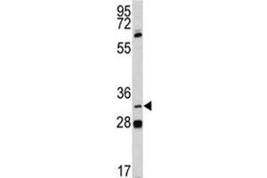 Western Blotting (WB) image for anti-Paired-Like Homeodomain 1 (PITX1) (AA 123-150) antibody (ABIN3032139)