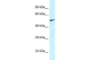WB Suggested Anti-Eya2 Antibody Titration: 1. (EYA2 抗体  (Middle Region))
