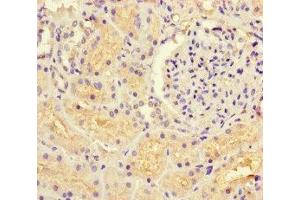 Immunohistochemistry of paraffin-embedded human kidney tissue using ABIN7154769 at dilution of 1:100 (GUCY1A1 抗体  (AA 20-152))