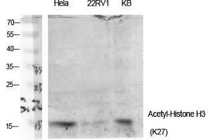 Western Blot (WB) analysis of specific cells using Acetyl-Histone H3 (K27) Polyclonal Antibody. (Histone 3 抗体  (H3K27ac))