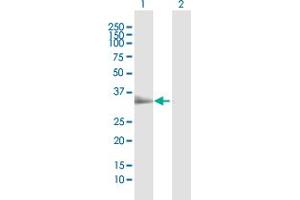 Western Blotting (WB) image for anti-Toll-Interleukin 1 Receptor (TIR) Domain Containing Adaptor Protein (TIRAP) (AA 1-256) antibody (ABIN949800)