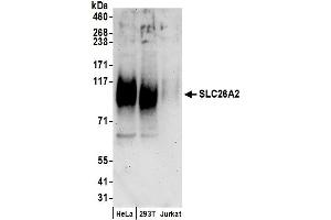 Western Blotting (WB) image for anti-Solute Carrier Family 26 (Sulfate Transporter), Member 2 (SLC26A2) (AA 1-50) antibody (ABIN7450738)