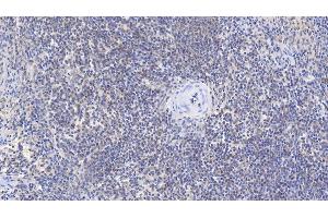 Detection of b2M in Human Spleen Tissue using Monoclonal Antibody to Beta-2-Microglobulin (b2M) (beta-2 Microglobulin 抗体  (AA 22-119))