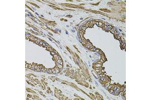 Immunohistochemistry of paraffin-embedded human prostate using FLNB antibody.