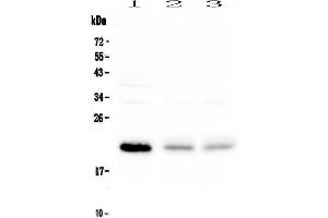 Western blot analysis of BNIP3 using anti-BNIP3 antibody . (BNIP3 抗体)