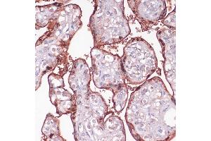 Immunohistochemistry of paraffin-embedded human placenta using S100P antibody (ABIN7270133) at dilution of 1:100 (40x lens). (S100P 抗体  (AA 1-95))