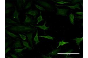 Immunofluorescence of monoclonal antibody to C14orf129 on HeLa cell. (GSKIP 抗体  (AA 1-139))