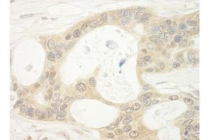 Immunohistochemistry (IHC) image for anti-Folliculin (FLCN) (AA 1-50) antibody (ABIN7448434) (FLCN 抗体  (AA 1-50))