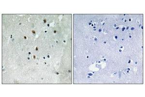 Immunohistochemistry analysis of paraffin-embedded human brain tissue using SRF (Phospho-Ser77) antibody. (SRF 抗体  (pSer77))