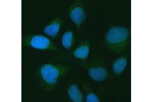 IF analysis of USP16 using anti-USP16 antibody (ABIN7599650). (USP16 抗体  (AA 103-683))