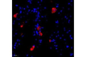 Immunofluorescence of paraffin embedded mouse lymph node using BIRC3 (ABIN7073179) at dilution of 1: 1000 (400x lens) (BIRC3 抗体)