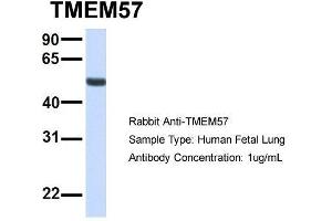 Host:  Rabbit  Target Name:  TMEM57  Sample Type:  Human Fetal Lung  Antibody Dilution:  1. (TMEM57 抗体  (N-Term))