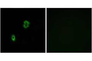 Immunofluorescence (IF) image for anti-Chemokine (C-C Motif) Receptor 7 (CCR7) (AA 170-219) antibody (ABIN2890754) (CCR7 抗体  (AA 170-219))