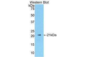 Western Blotting (WB) image for anti-Sex Hormone Binding Globulin (SHBG) (AA 219-358) antibody (ABIN1172838) (SHBG 抗体  (AA 219-358))