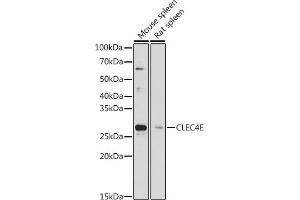 Western blot analysis of extracts of various cell lines, using CLEC4E antibody (ABIN7265982) at 1:1000 dilution. (CLEC4E 抗体)