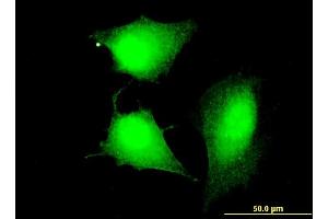 Immunofluorescence of monoclonal antibody to CCDC83 on HeLa cell.