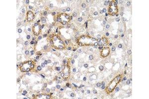 Immunohistochemistry of paraffin-embedded Rat kidney using CD83 Polyclonal Antibody at dilution of 1:200 (40x lens). (CD83 抗体)