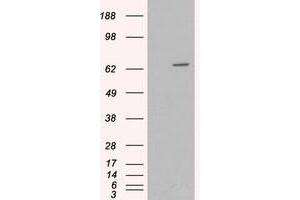 Image no. 2 for anti-Myotubularin 1 (MTM1) (C-Term) antibody (ABIN374119)