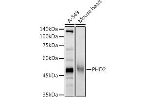 Western blot analysis of extracts of various cell lines, using PHD2 antibody (ABIN7266909) at 1:1000 dilution. (EGLN1 抗体  (AA 1-426))