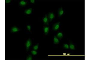 Image no. 2 for anti-AT Rich Interactive Domain 1B (SWI1-Like) (ARID1B) (AA 1364-1461) antibody (ABIN599288) (ARID1B 抗体  (AA 1364-1461))