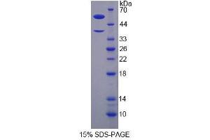 SDS-PAGE analysis of Human H2AFY Protein. (H2AFY 蛋白)
