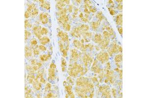Immunohistochemistry of paraffin-embedded rat pancreas using FLT3 antibody (ABIN6134576, ABIN6140691, ABIN6140694 and ABIN6216061) at dilution of 1:100 (40x lens). (FLT3 抗体  (AA 650-750))
