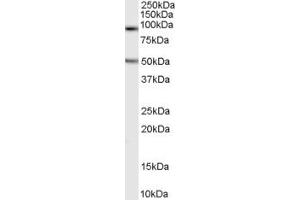 Western Blotting (WB) image for anti-Chromosome 16 Open Reading Frame 90 (C16ORF90) (N-Term) antibody (ABIN2791458) (C16ORF90 抗体  (N-Term))