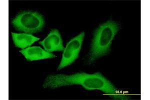 Immunofluorescence of monoclonal antibody to FASN on HeLa cell. (Fatty Acid Synthase 抗体  (AA 1-439))