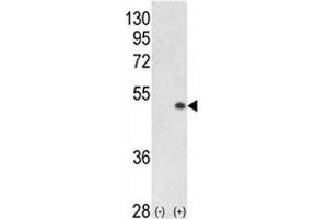 Western blot analysis of PCTAIRE1 antibody and 293 cell lysate (2 ug/lane) either nontransfected (Lane 1) or transiently transfected with the PCTK1 gene (2). (CDK16 抗体  (AA 357-386))