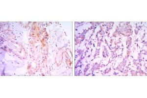 Immunohistochemistry (IHC) image for anti-RPTOR Independent Companion of mTOR, Complex 2 (RICTOR) antibody (ABIN969382)