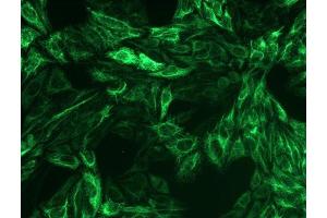 Immunocytochemistry staining of cytokeratin 8 in Hep-2 cells using mouse monoclonal antibody C-51 ((ABIN94298), diluted 1:200), detected with GAM IgG-Alexa Fluor488 (diluted 1:100, green). (KRT8 抗体)