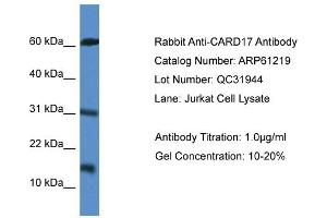 Western Blotting (WB) image for anti-Caspase Recruitment Domain Family, Member 17 (CARD17) (Middle Region) antibody (ABIN2788724) (CARD17 抗体  (Middle Region))